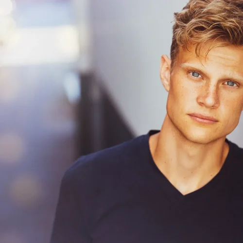 a man with blue eyes and freckles